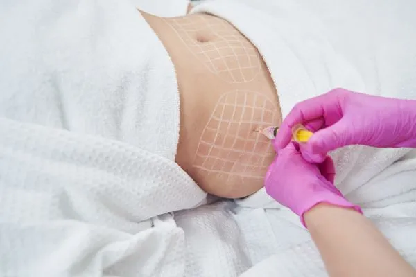 image of fat dissolving injections on love handles to help combat weight gain Seacombe